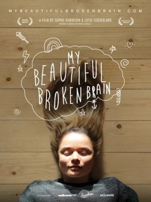Khối Óc Xinh Đẹp Tội Nghiệp Của Tôi - My Beautiful Broken Brain (2014)